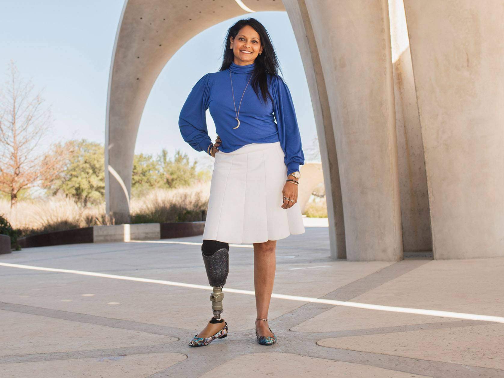 woman standing with leg prosthetic 