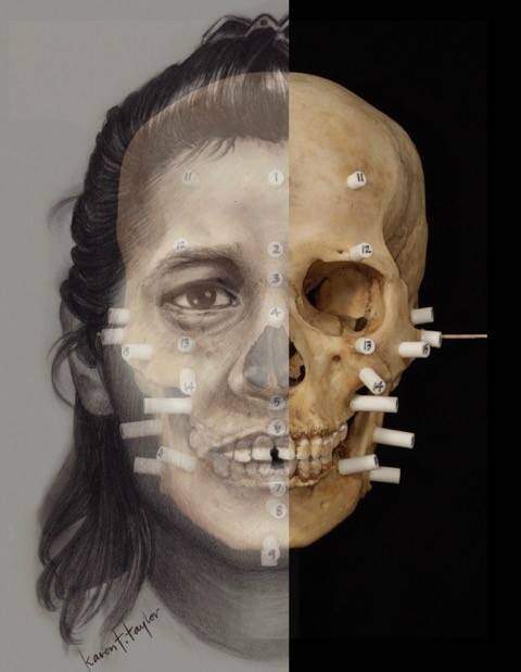Craniofacial reconstruction drawing