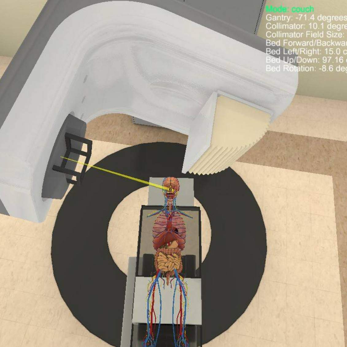 Setting up the patient in organ view