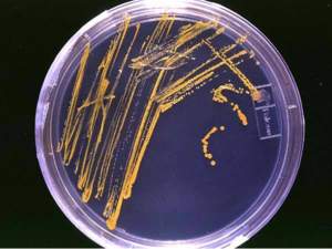 Petri dish with bacterial growth
